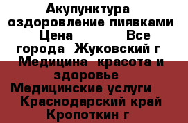 Акупунктура, оздоровление пиявками › Цена ­ 3 000 - Все города, Жуковский г. Медицина, красота и здоровье » Медицинские услуги   . Краснодарский край,Кропоткин г.